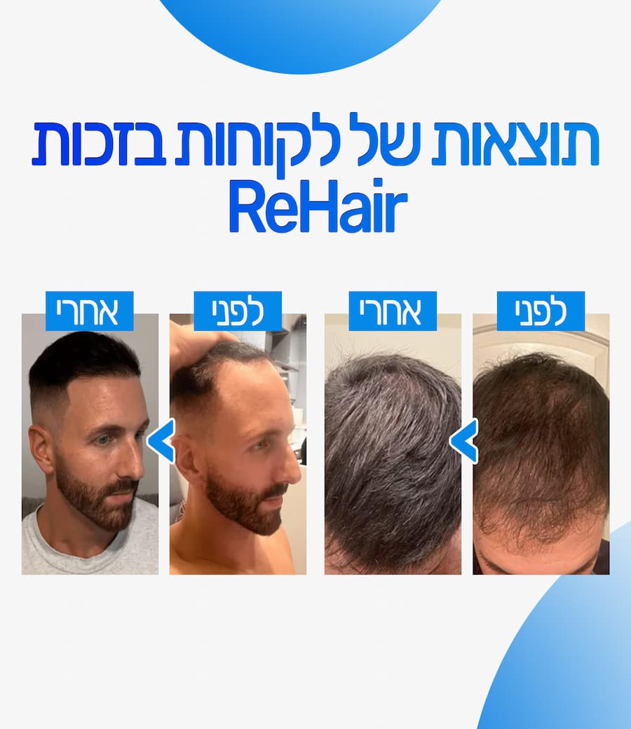 ערכת טיפול מלאה לשיער