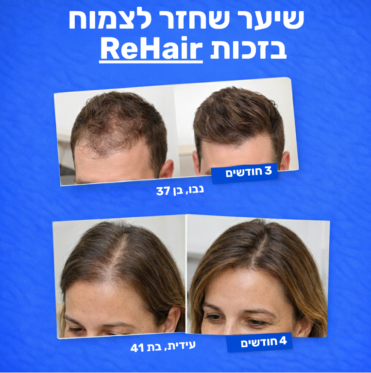 ReHair - סרום להצמחת השיער